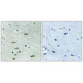 Immunohistochemistry analysis of paraffin-embedded human brain tissue using IGF1R (Ab-1346) antibody.