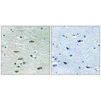 Immunohistochemistry analysis of paraffin-embedded human brain tissue using IGF1R (Ab-1346) antibody.