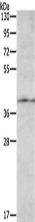 Gel: 10%SDS-PAGE, Lysate: 40 ug, Lane: 231 cells, Primary antibody: CSB-PA943276(AGTR1 Antibody) at dilution 1/200, Secondary antibody: Goat anti rabbit IgG at 1/8000 dilution, Exposure time: 1 minute