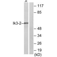 Western blot analysis of extracts from Jurkat cells, using Ik3-2 antibody.