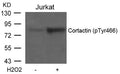 Western blot analysis of extracts from Jurkat cells untreated or treated with H2O2 using Cortactin(Phospho-Tyr466) Antibody.