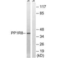 Western blot analysis of extracts from Jurkat cells, using PPP1R8 antibody.
