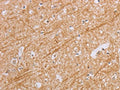 The image on the left is immunohistochemistry of paraffin-embedded Human brain tissue using CSB-PA944463(BGLAP Antibody) at dilution 1/40, on the right is treated with synthetic peptide. (Original magnification: ×200)
