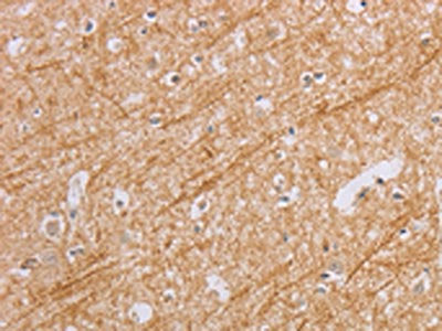 The image on the left is immunohistochemistry of paraffin-embedded Human brain tissue using CSB-PA944463(BGLAP Antibody) at dilution 1/40, on the right is treated with synthetic peptide. (Original magnification: ×200)