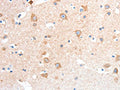 The image on the left is immunohistochemistry of paraffin-embedded Human brain tissue using CSB-PA944795(ANXA8 Antibody) at dilution 1/25, on the right is treated with fusion protein. (Original magnification: ×200)