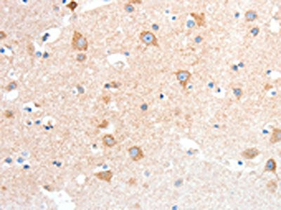The image on the left is immunohistochemistry of paraffin-embedded Human brain tissue using CSB-PA944795(ANXA8 Antibody) at dilution 1/25, on the right is treated with fusion protein. (Original magnification: ×200)