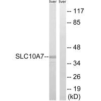 Western blot analysis of extracts from mouse liver cells, using SLC10A7 antibody.