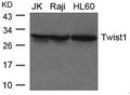 Western blot analysis of extracts from JK, Raji and HL-60 cells using Twist1 Antibody.