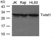 Western blot analysis of extracts from JK, Raji and HL-60 cells using Twist1 Antibody.