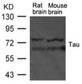 Western blot analysis of extract from rat brain and mouse brain tissue using TAU Antibody