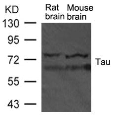 Western blot analysis of extract from rat brain and mouse brain tissue using TAU Antibody