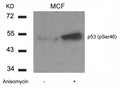 Western blot analysis of extracts from MCF cells untreated or treated with Anisomycin using p53(Phospho-Ser46) Antibody.