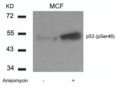 Western blot analysis of extracts from MCF cells untreated or treated with Anisomycin using p53(Phospho-Ser46) Antibody.
