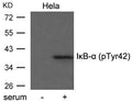 Western blot analysis of extract from Hela cells untreated or treated with serum using IkB-a(Phospho-Tyr42) antibody.