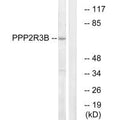 Western blot analysis of extracts from K562 cells, using P2R3B antibody.