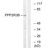 Western blot analysis of extracts from K562 cells, using P2R3B antibody.