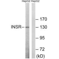 Western blot analysis of extracts from HepG2 cells, using INSR (Ab-1375) antibody.