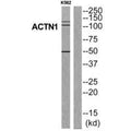 Western blot analysis of extracts from K562 cells, using ACTN1 antibody.