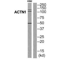Western blot analysis of extracts from K562 cells, using ACTN1 antibody.