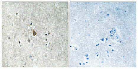 Immunohistochemical analysis of paraffin-embedded human brain tissue using IGF1R (Phospho-Tyr1346) antibody (left)or the same antibody preincubated with blocking peptide (right).