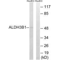 Western blot analysis of extracts from HuvEc cells, using ALDH3B1 antibody.