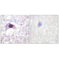 Immunohistochemical analysis of paraffin-embedded human brain tissue using E2F6 antibody.