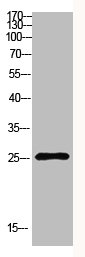 Western Blot analysis of NT28 cells using Antibody diluted at 500. Secondary antibody  was diluted at 1:20000