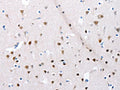 The image on the left is immunohistochemistry of paraffin-embedded Human brain tissue using CSB-PA946193(POMC Antibody) at dilution 1/30, on the right is treated with synthetic peptide. (Original magnification: ×200)