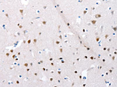 The image on the left is immunohistochemistry of paraffin-embedded Human brain tissue using CSB-PA946193(POMC Antibody) at dilution 1/30, on the right is treated with synthetic peptide. (Original magnification: ×200)