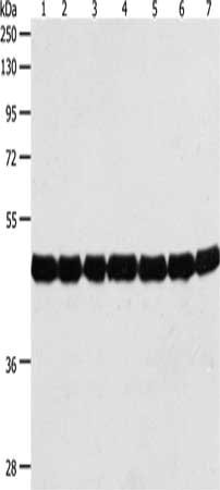 Gel: 10%SDS-PAGE, Lysate: 50 ug, Lane 1-7: Cinnamomum camphora tissue, Nicotiana tabacum tissue, Triticum aestivuml, Arabidopsis thaliana leaves, Brassica campestris flowers, Brassica campestris, Vicit Faba leaves, Primary antibody: CSB-PA946648(ACTIN Antibody) at dilution 1/500, Secondary antibody: Goat anti rabbit IgG at 1/8000 dilution, Exposure time: 20 seconds
