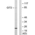 Western blot analysis of extracts from HepG2 cells, using GIT2 antibody.
