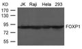 Western blot analysis of extract from JK, Raji, Hela and 293 cells using FOXP1 Antibody