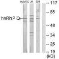 Western blot analysis of extracts from HUVEC cells, Jurkat cells and 293 cells, using hnRNP Q antibody.
