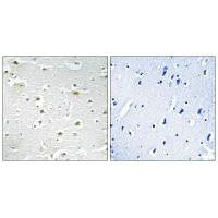 Immunohistochemistry analysis of paraffin-embedded human brain tissue using DDX3Y antibody.