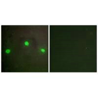 Immunofluorescence analysis of A549 cells, using ATRX antibody.