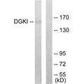 Western blot analysis of extracts from 293 cells, using DGKI antibody.