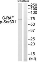 Western blot analysis of extracts from HuvEc, using C-RAF (Phospho-Ser301) antibody. The lane on the right is treated with the synthesized peptide.