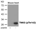 Western blot analysis of extracts from  Mouse heart tissue using TNNI3 (Phospho-Thr142) Antibody.The lane on the left is treated with the antigen-specific peptide.