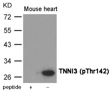 Western blot analysis of extracts from  Mouse heart tissue using TNNI3 (Phospho-Thr142) Antibody.The lane on the left is treated with the antigen-specific peptide.