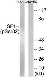 Western blot analysis of extracts from HUVEC cells treated with anisomycin using SF1 (Phospho-Ser82) Antibody.The lane on the right is treated with the antigen-specific peptide.