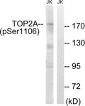 Western blot analysis of extracts from Jurkat cells, treated with paclitaxel (1uM, 24hours), using TOP2A (Phospho-Ser1106) antibody. The lane on the right is treated with the synthesized peptide.