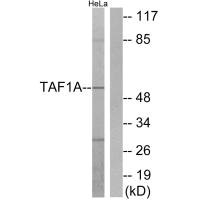 Western blot analysis of extracts from HeLa cells, using TAF1A antibody.