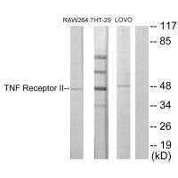 Western blot analysis of extracts from RAW264.7 cells, HT-29 cells and LOVO cells, using TNF Receptor II antibody.