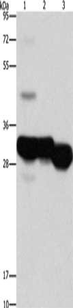 Gel: 15%SDS-PAGE, Lysate: 40 ug, Lane 1-3: Mouse liver tissue, Mouse kidney tissue, human fetal liver tissue, Primary antibody: CSB-PA950592(KHK Antibody) at dilution 1/1250, Secondary antibody: Goat anti rabbit IgG at 1/8000 dilution, Exposure time: 3 seconds