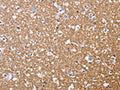 The image on the left is immunohistochemistry of paraffin-embedded Human brain tissue using CSB-PA951068(MAG Antibody) at dilution 1/20, on the right is treated with fusion protein. (Original magnification: ×200)