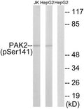 Western blot analysis of extracts from HepG2 cells treated with Adriamycin (0.5uM, 24hours) and Jurkat cells treated with PMA (125ng/ml, 30mins) using PAK2 (Phospho-Ser141) antibody. The lane on the right is treated with the synthesized peptide.
