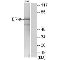 Western blot analysis of extracts from 293cells, using Estrogen Receptor-α (Ab-537) antibody.