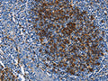The image on the left is immunohistochemistry of paraffin-embedded Human tonsil tissue using CSB-PA951901(FCER2 Antibody) at dilution 1/40, on the right is treated with fusion protein. (Original magnification: ×200)