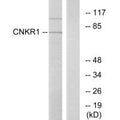 Western blot analysis of extracts from COLO cells, using CNKR1 antibody.
