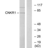 Western blot analysis of extracts from COLO cells, using CNKR1 antibody.